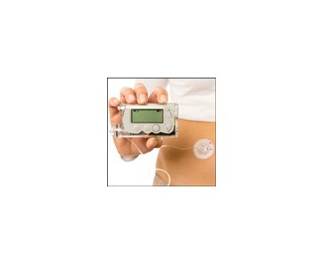 Dymax MD Medical Device Adhesive - 6000 cP Viscosity - Image 1